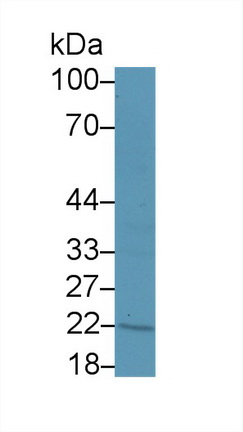 Polyclonal Antibody to Chorionic Gonadotropin Beta Polypeptide 1 (CGb1)