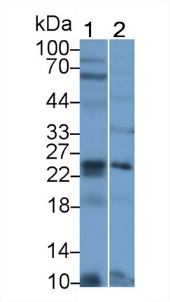 Polyclonal Antibody to Calcium Binding Protein P22 (CHP)