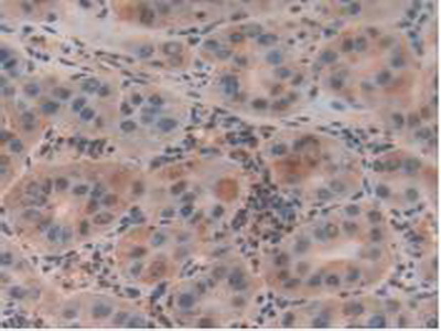 Polyclonal Antibody to Chloride Intracellular Channel Protein 1 (CLIC1)