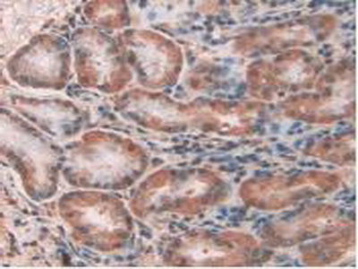 Polyclonal Antibody to Chloride Intracellular Channel Protein 1 (CLIC1)