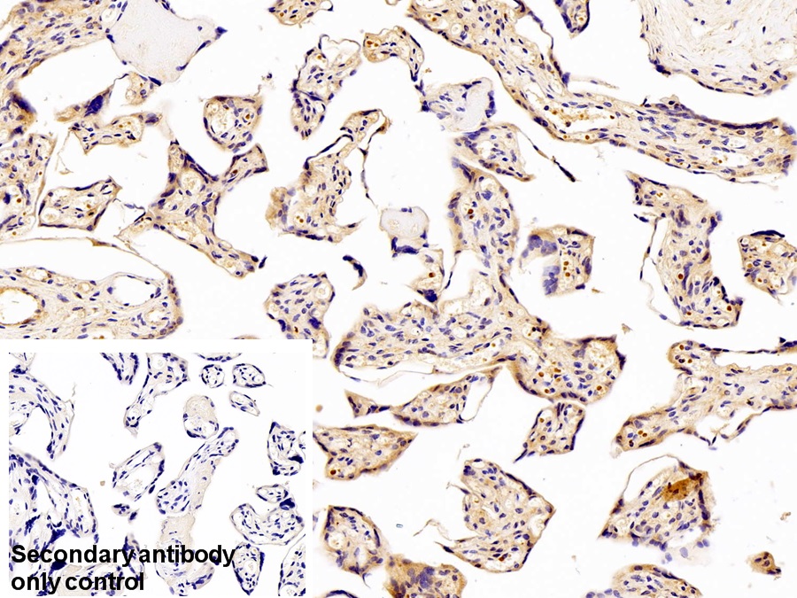 Polyclonal Antibody to Chloride Intracellular Channel Protein 1 (CLIC1)