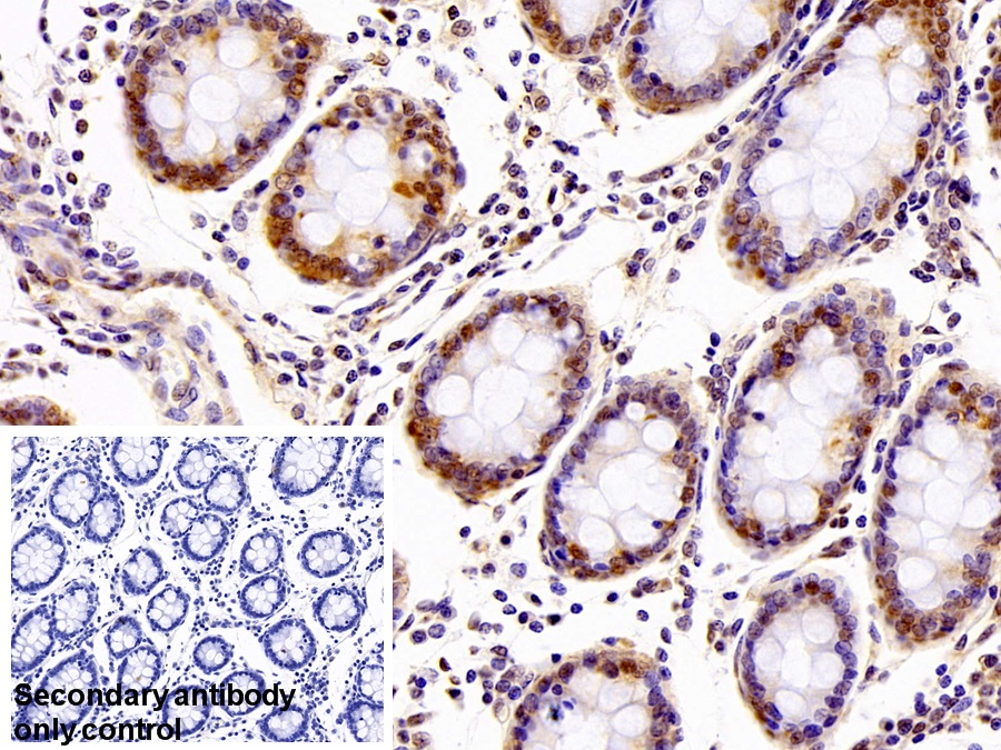 Polyclonal Antibody to Chloride Intracellular Channel Protein 1 (CLIC1)