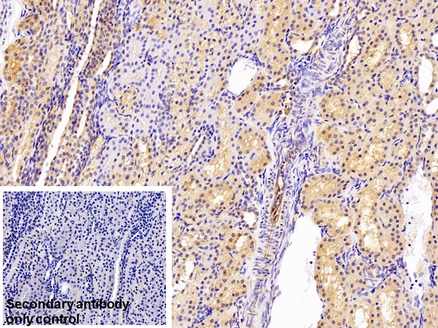 Polyclonal Antibody to Chloride Intracellular Channel Protein 1 (CLIC1)