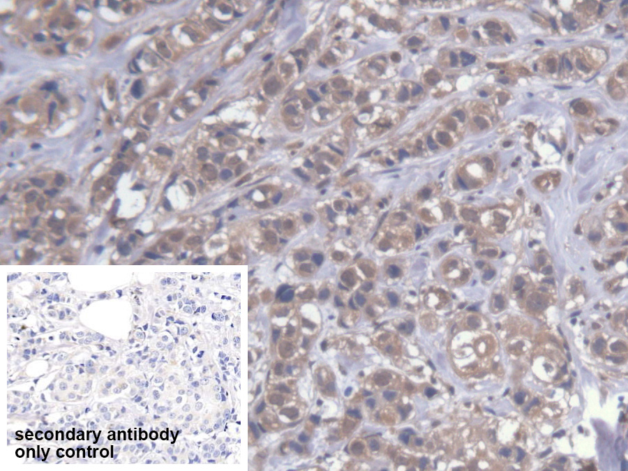 Polyclonal Antibody to Cytoplasmic Polyadenylation Element Binding Protein 1 (CPEB1)