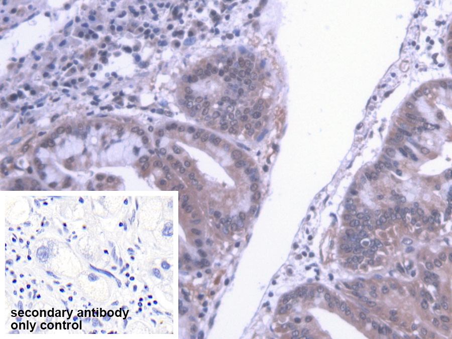 Polyclonal Antibody to Cytoplasmic Polyadenylation Element Binding Protein 1 (CPEB1)