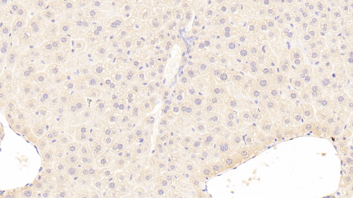 Polyclonal Antibody to Carnitine Acetyltransferase (CRAT)