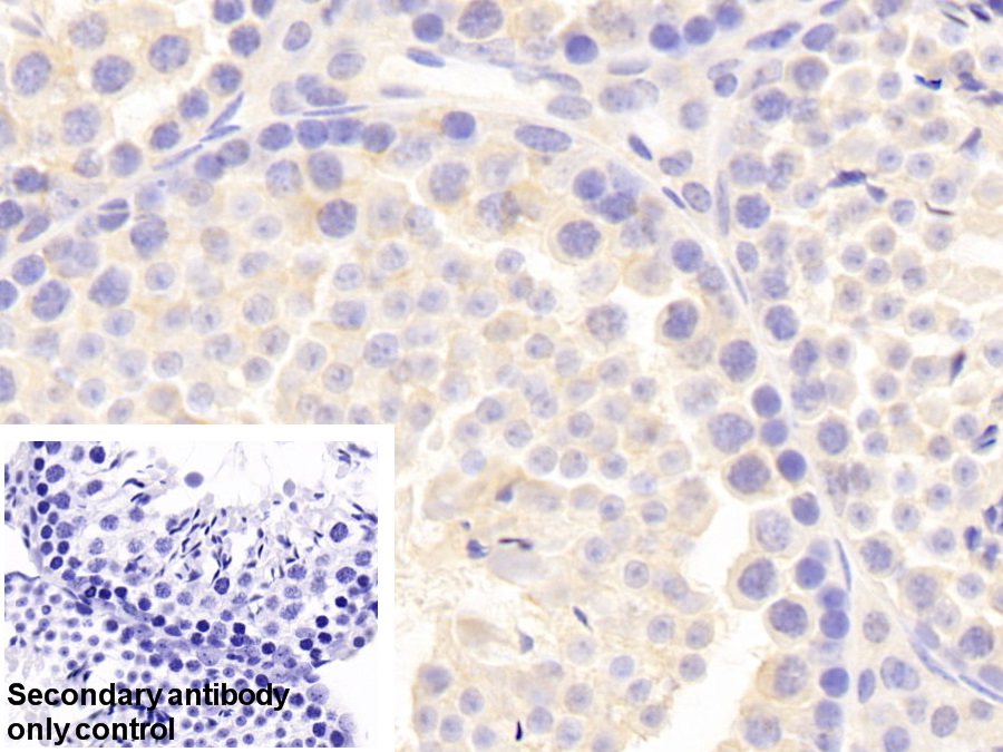 Polyclonal Antibody to Carnitine Acetyltransferase (CRAT)