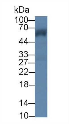 Polyclonal Antibody to Cisplatin Resistance Associated Overexpressed Protein (CROP)