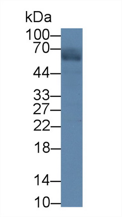 Polyclonal Antibody to Cisplatin Resistance Associated Overexpressed Protein (CROP)