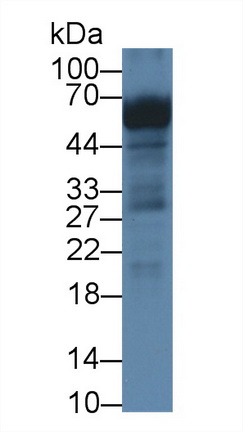 Polyclonal Antibody to Cisplatin Resistance Associated Overexpressed Protein (CROP)