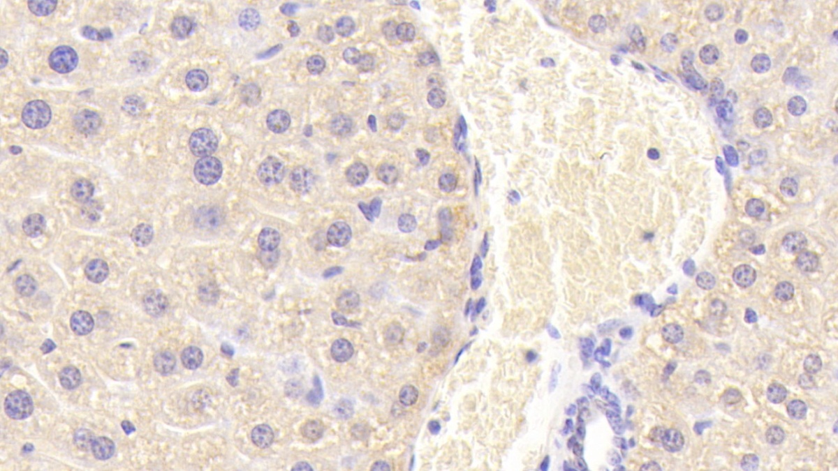 Polyclonal Antibody to Carnitine-O-Octanoyltransferase (CORT)