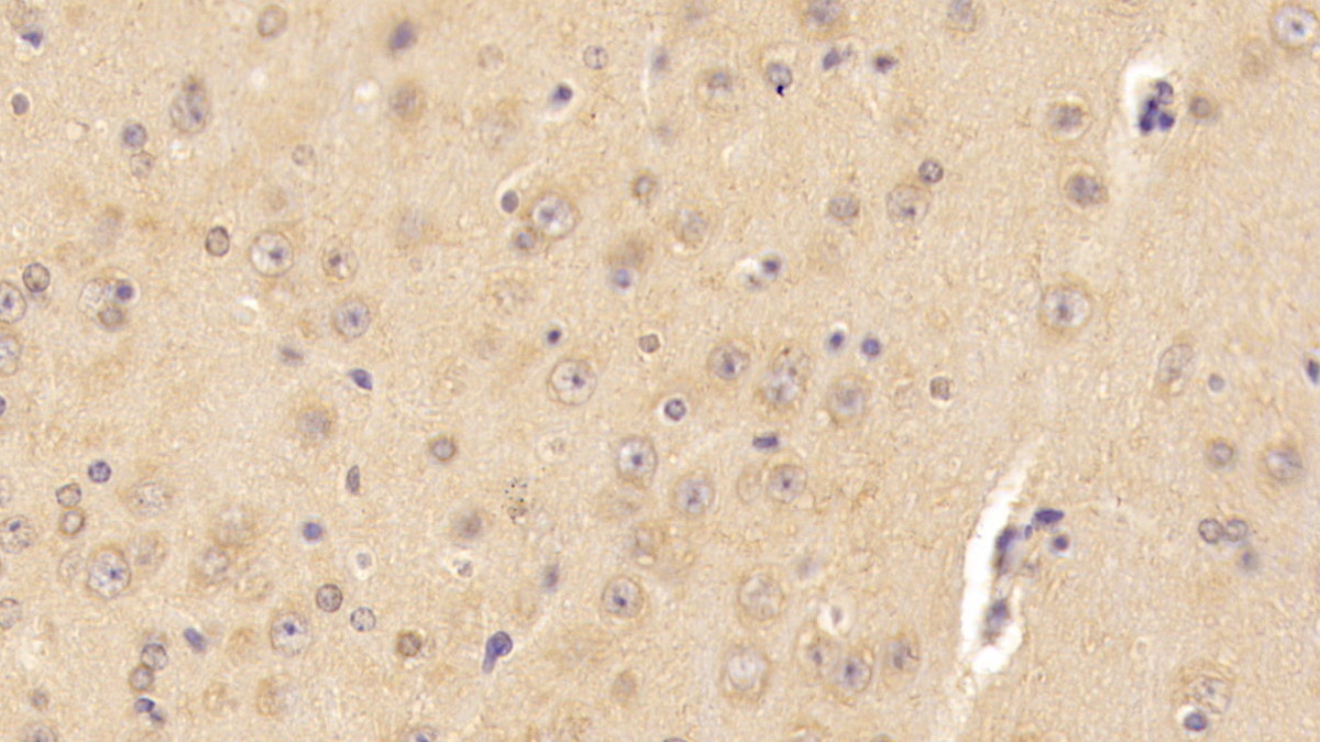 Polyclonal Antibody to Carnitine-O-Octanoyltransferase (CORT)