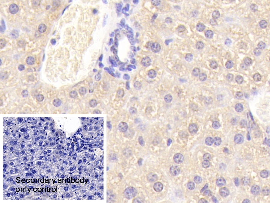 Polyclonal Antibody to Carnitine-O-Octanoyltransferase (CORT)