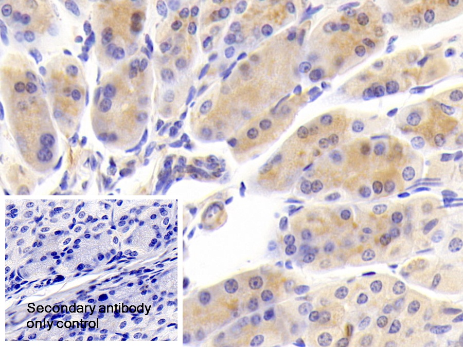 Polyclonal Antibody to Carnitine-O-Octanoyltransferase (CORT)