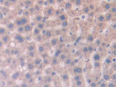 Polyclonal Antibody to Cubilin (CUBN)