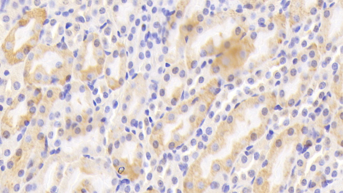 Polyclonal Antibody to Calcitonin Receptor (CTR)