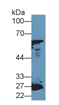 Polyclonal Antibody to Catalase (CAT)