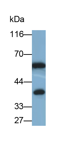 Polyclonal Antibody to Catalase (CAT)