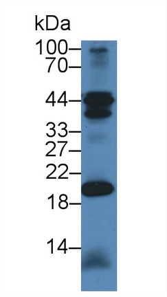 Polyclonal Antibody to Chimerin 2 (CHN2)