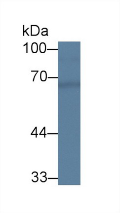 Polyclonal Antibody to Chimerin 2 (CHN2)