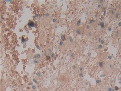 Polyclonal Antibody to Cylindromatosis (CYLD)