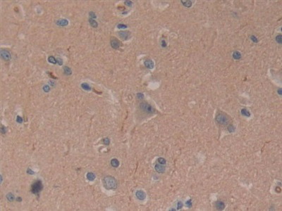 Polyclonal Antibody to Cylindromatosis (CYLD)