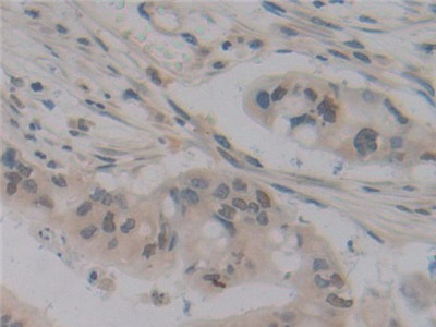 Polyclonal Antibody to Cylindromatosis (CYLD)