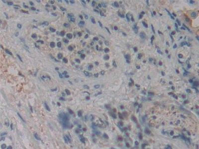 Polyclonal Antibody to Cylindromatosis (CYLD)