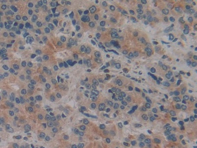 Polyclonal Antibody to Cylindromatosis (CYLD)