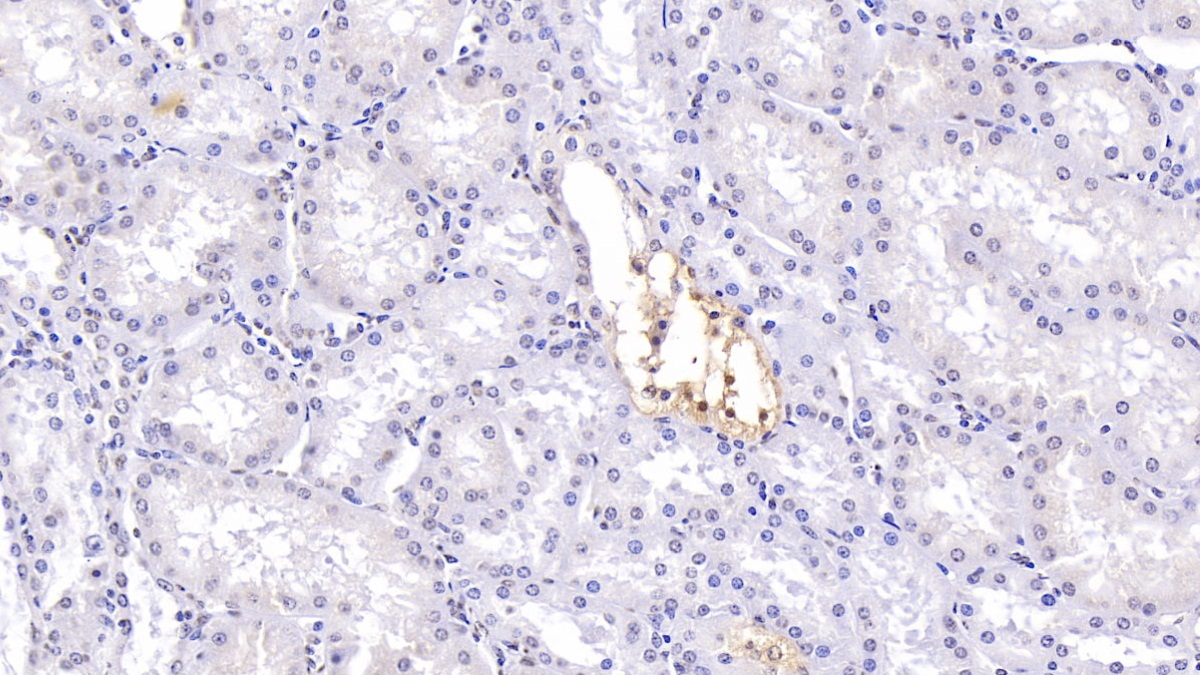 Polyclonal Antibody to Cystic Fibrosis Transmembrane Conductance Regulator (CFTR)