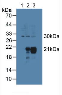 Polyclonal Antibody to Cytoglobin (CYGB)