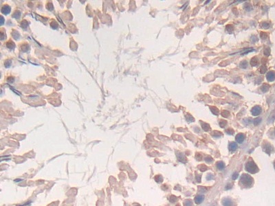 Polyclonal Antibody to Cytoglobin (CYGB)