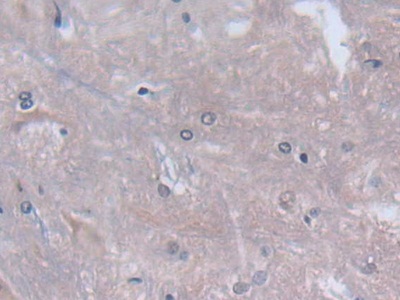 Polyclonal Antibody to Cytoglobin (CYGB)