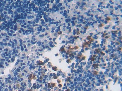 Polyclonal Antibody to Cytoglobin (CYGB)