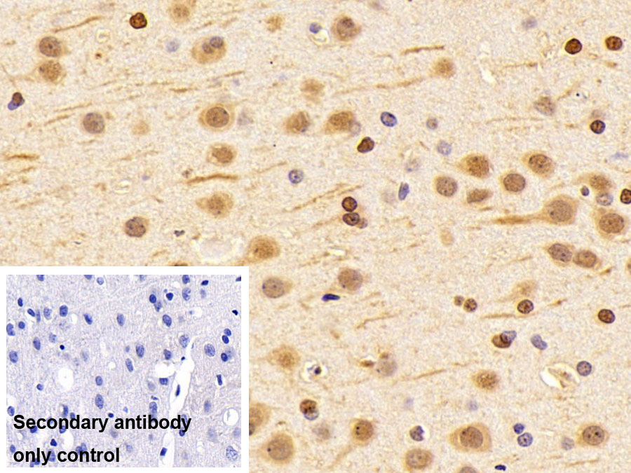 Polyclonal Antibody to Cytoglobin (CYGB)