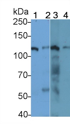 Polyclonal Antibody to Dishevelled Associated Activator Of Morphogenesis 1 (DAAM1)