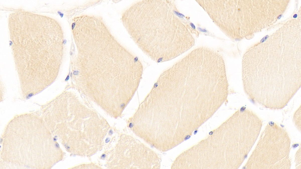 Polyclonal Antibody to Dishevelled Associated Activator Of Morphogenesis 1 (DAAM1)