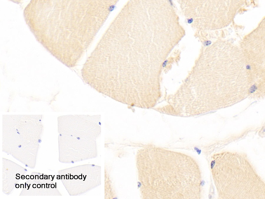 Polyclonal Antibody to Dishevelled Associated Activator Of Morphogenesis 1 (DAAM1)