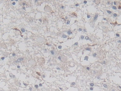 Polyclonal Antibody to Drebrin 1 (DBN1)