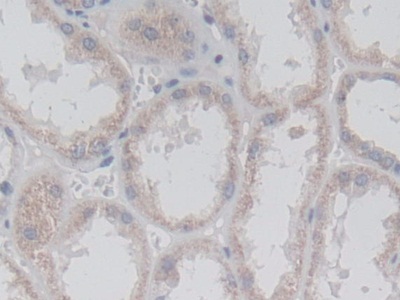 Polyclonal Antibody to Drebrin 1 (DBN1)