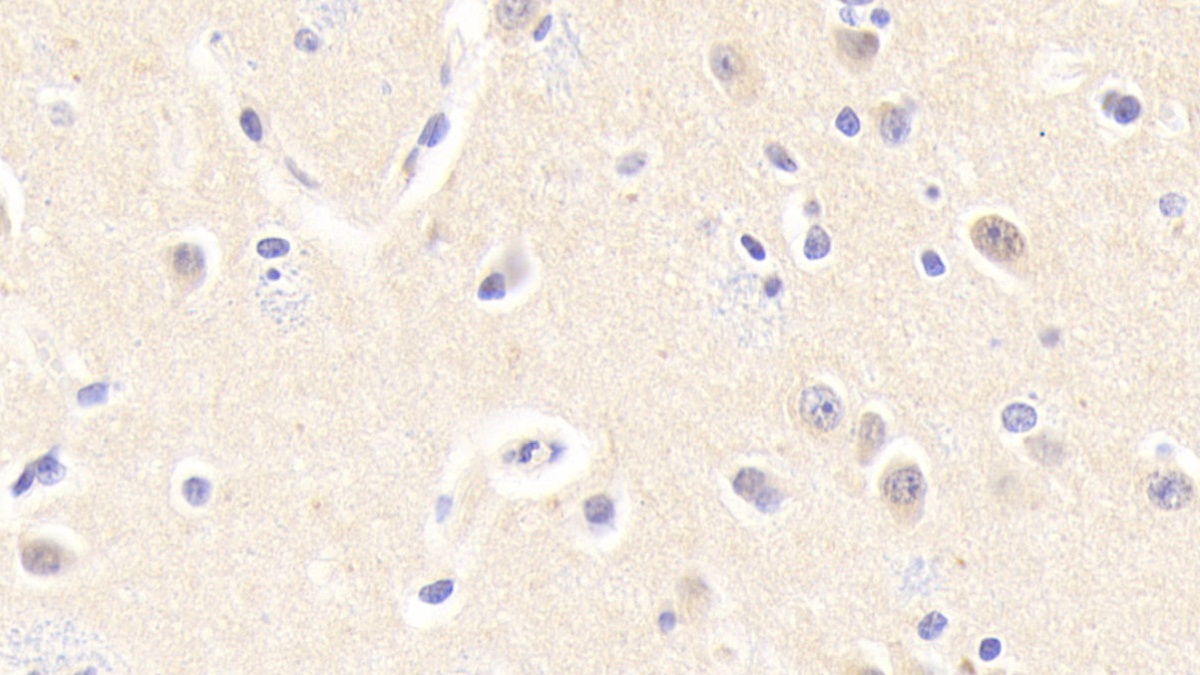 Polyclonal Antibody to Drebrin 1 (DBN1)