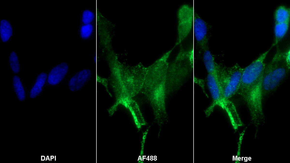 Polyclonal Antibody to Dermatopontin (DPT)