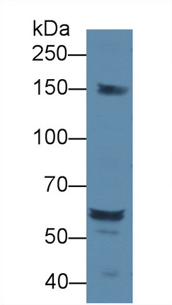 Polyclonal Antibody to Docking Protein 1 (DOK1)