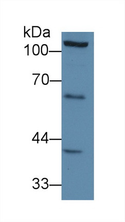 Polyclonal Antibody to Docking Protein 1 (DOK1)