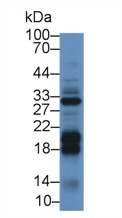 Polyclonal Antibody to Diacylglycerol Kinase Alpha (DGKa)