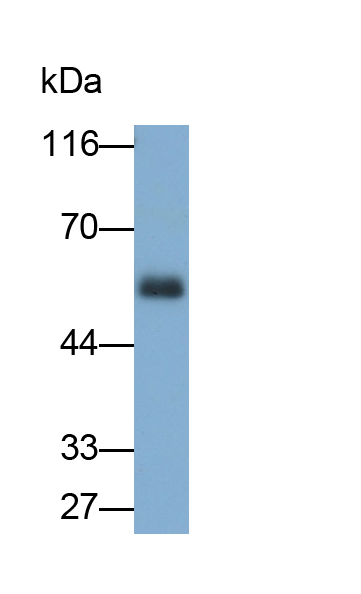 Polyclonal Antibody to Dipeptidase 1, Renal (DPEP1)