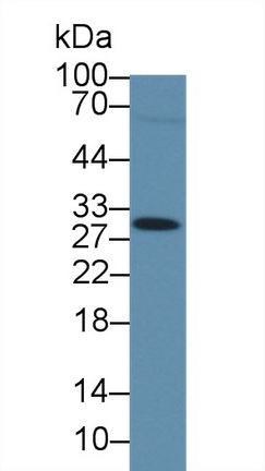 Polyclonal Antibody to Dystrobrevin Binding Protein 1 (DTNBP1)