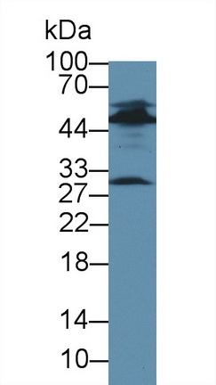 Polyclonal Antibody to Dystrobrevin Binding Protein 1 (DTNBP1)