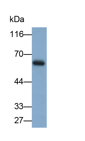 Polyclonal Antibody to Dyskerin (DKC)