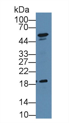 Polyclonal Antibody to Dyskerin (DKC)